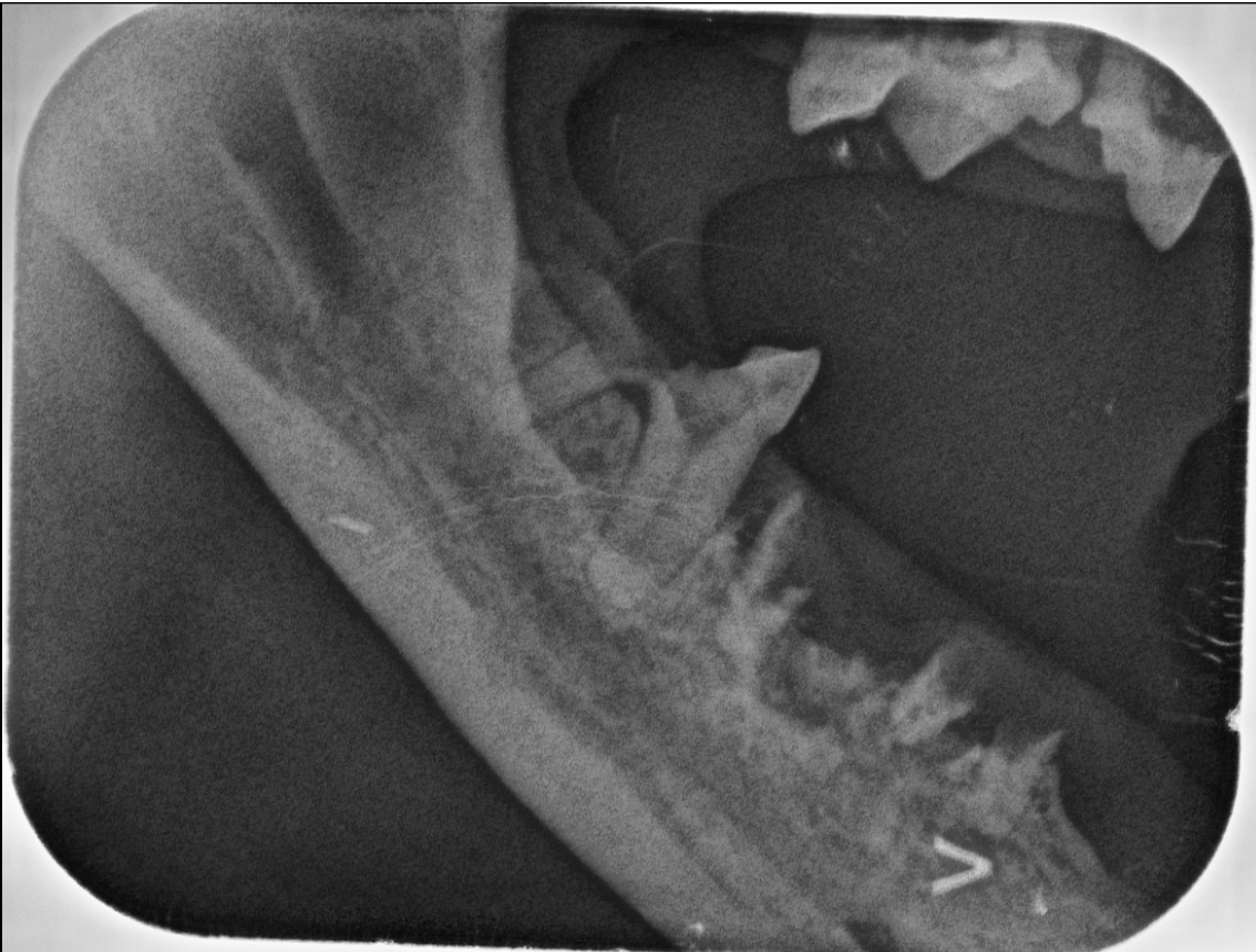 Dentales Röntgen