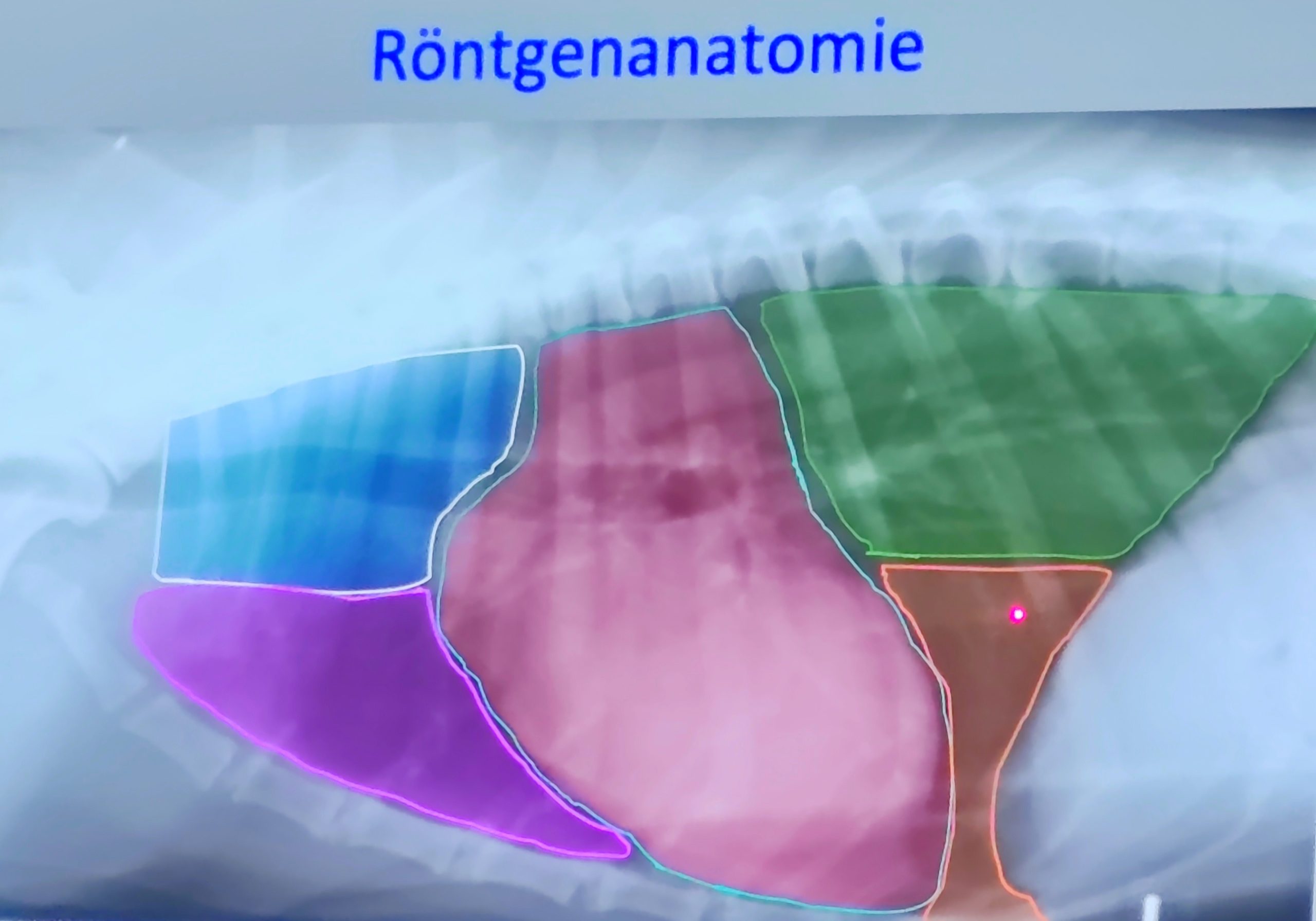 Röntgenkurs.. Alles schwarz-weiß?